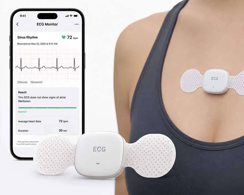 ECG-patch
