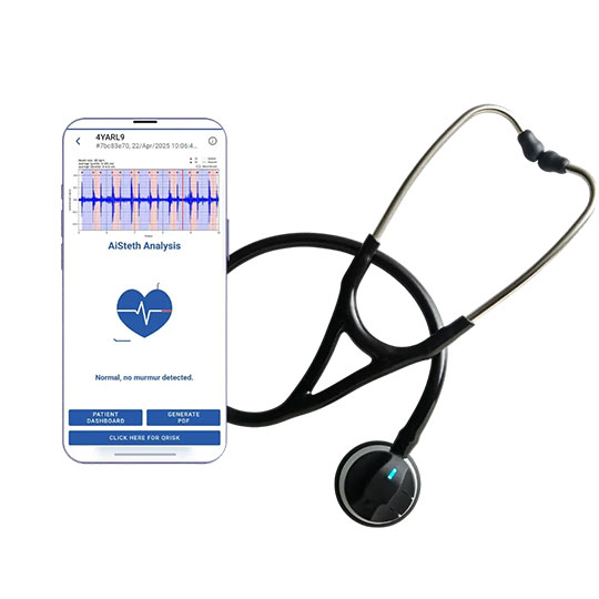 AI-powered-electronic-stethoscope