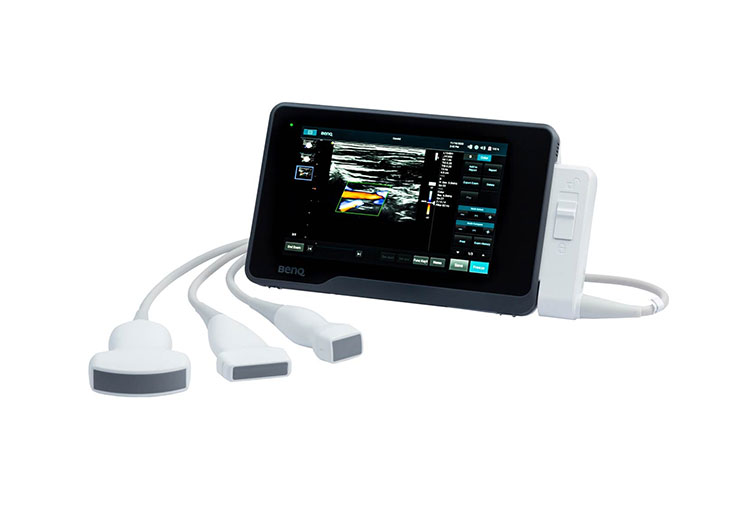 Portable-Ultrasound--1
