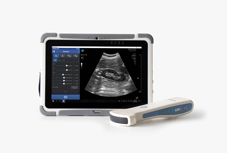 Portable-Ultrasound--2